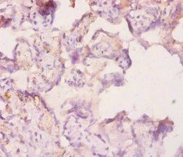ANGPT2 Antibody
