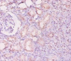 ANGPT2 Antibody