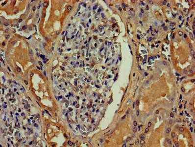 ANGPT2 Antibody
