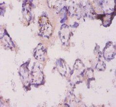 Angpt2 Antibody