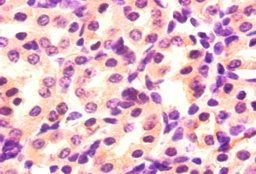 Angpt2 Antibody