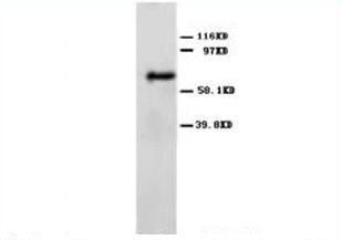Angiopoietin 2/ANGPT2 Rabbit Polyclonal Antibody