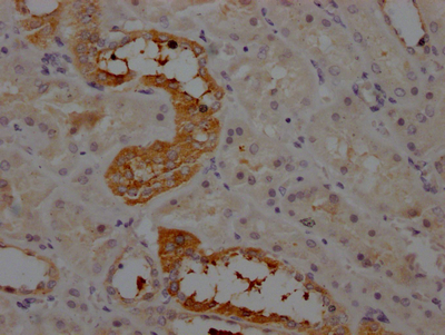 AGT Antibody