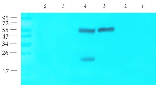 CD69 Rabbit Polyclonal Antibody