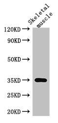 ANKRD23 Antibody