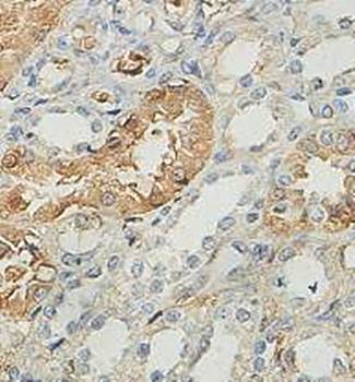 ANKRD5 Rabbit Polyclonal Antibody