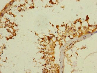 ANKS1B Antibody