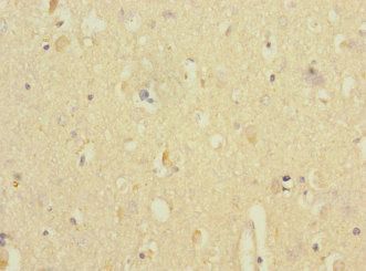 ANKS1B Antibody