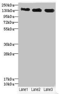 ANKS1B Antibody