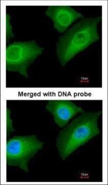 Annexin A1 Rabbit Polyclonal Antibody