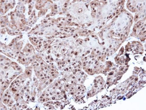 Annexin A1 Rabbit Polyclonal Antibody