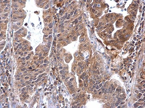 Annexin VII Rabbit Polyclonal Antibody