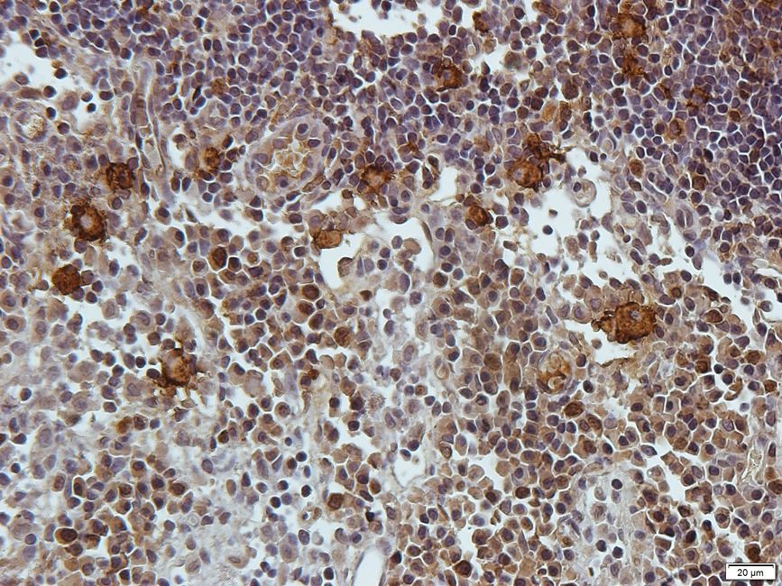 Antigen KI-67 Rabbit Polyclonal Antibody