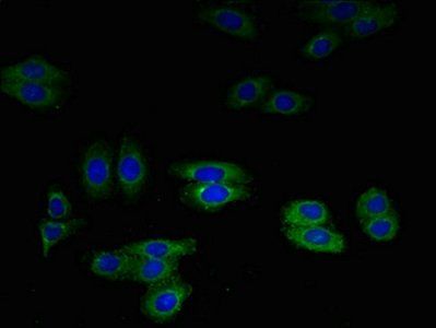 SLPI Antibody