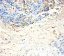 SLPI Antibody