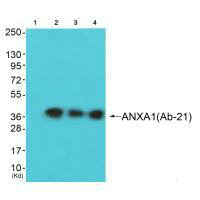 ANXA1 Antibody