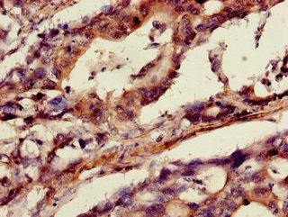 ANXA10 Antibody