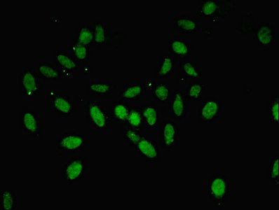 ANXA11 Antibody