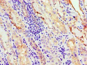 ANXA11 Antibody
