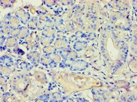 ANXA7 Antibody