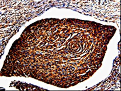 ANXA7 Antibody