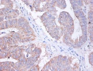 AP2S1 Antibody