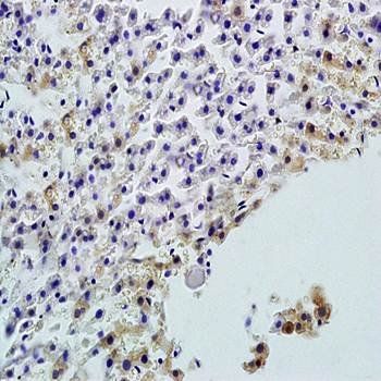 Alkaline Phosphatase, Tissue Non-Specific isozyme Rabbit Polyclonal Antibody