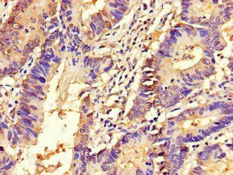 APEH Antibody