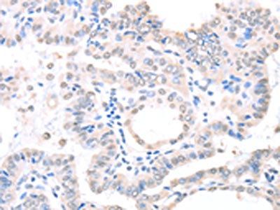 APEX1 Antibody