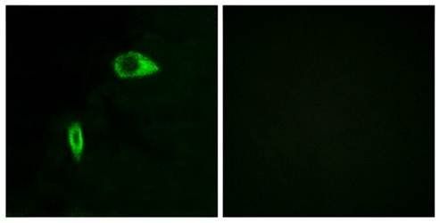 Collagen XIV α1 Antibody