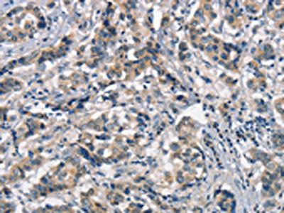 NAXE Antibody