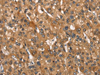 NAXE Antibody