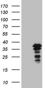 APOBR Antibody