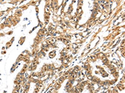 APOL6 Antibody
