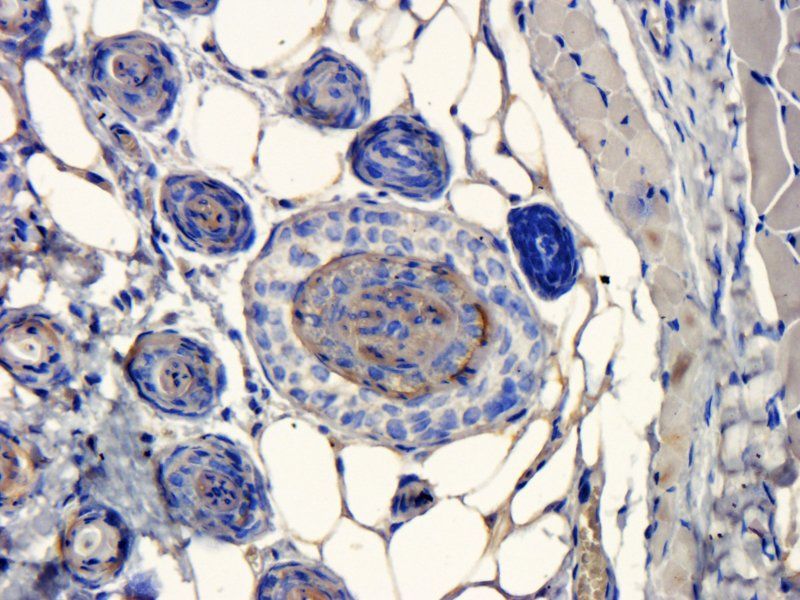 Apolipoprotein CIII Rabbit Polyclonal Antibody