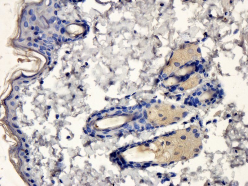 Apolipoprotein CIII Rabbit Polyclonal Antibody