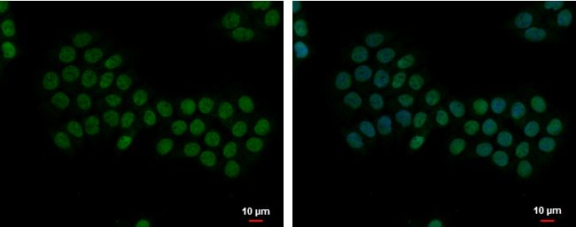 Apoptosis-enhancing nuclease Rabbit Polyclonal Antibody