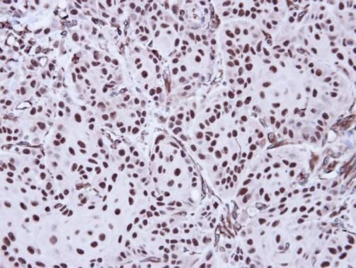 Apoptosis-enhancing nuclease Rabbit Polyclonal Antibody
