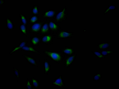 APP Antibody
