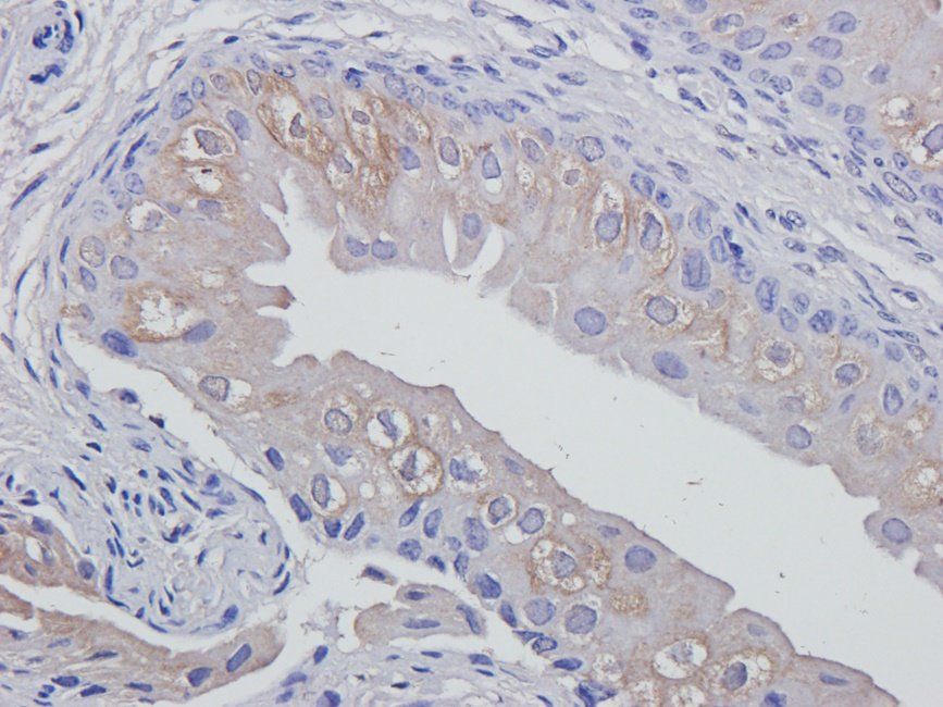 Aquaporin 7 Rabbit Polyclonal Antibody