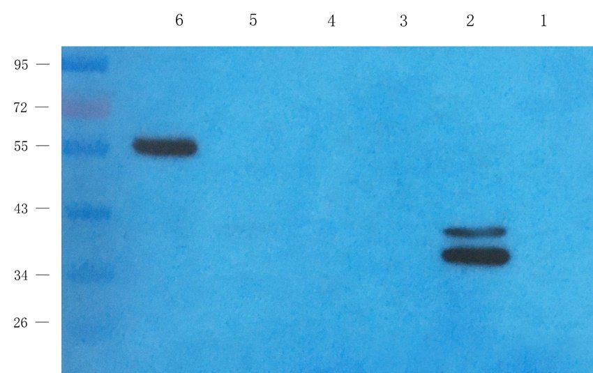 Aquaporin 7 Rabbit Polyclonal Antibody