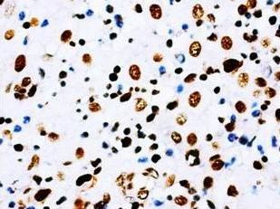 Aquaporin 1/AQP1 Rabbit Polyclonal Antibody