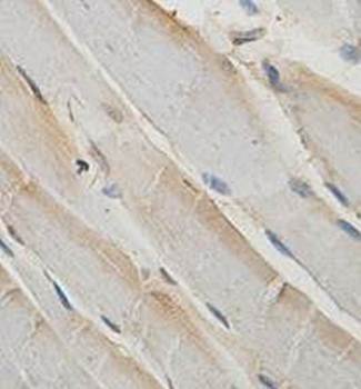 ARC Rabbit Polyclonal Antibody