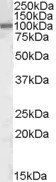 AREB6/ZEB1 Antibody