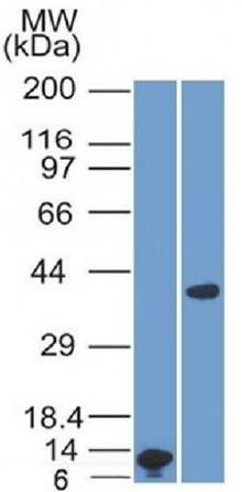 ARG1 Antibody