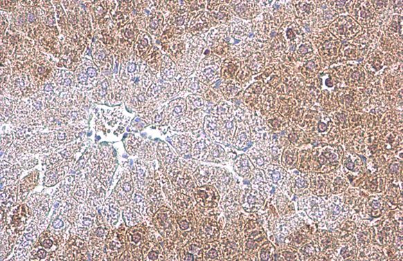 Arginase 1 Rabbit Polyclonal Antibody
