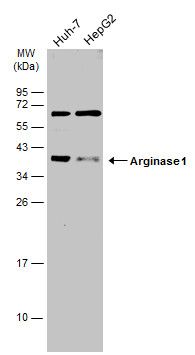 Arginase 1 Rabbit Polyclonal Antibody