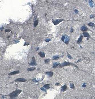 ARHGDIA Rabbit Polyclonal Antibody