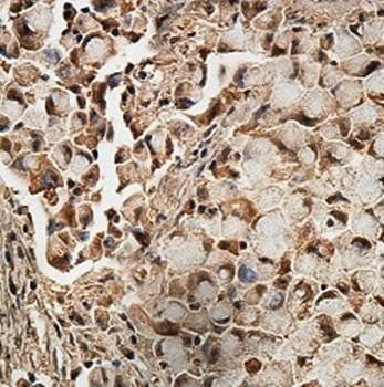 ARIH2 Rabbit Polyclonal Antibody