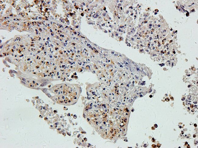ARL13B Rabbit Polyclonal Antibody